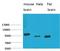 EPH Receptor A1 antibody, STJ97566, St John