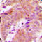 Ribosomal Protein S6 Kinase B1 antibody, LS-C352828, Lifespan Biosciences, Immunohistochemistry paraffin image 