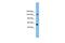 DEAH-Box Helicase 8 antibody, PA5-41268, Invitrogen Antibodies, Western Blot image 