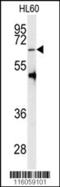 Protein Arginine Methyltransferase 5 antibody, 55-030, ProSci, Western Blot image 