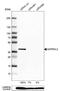 ADP-Ribosylhydrolase Like 2 antibody, NBP1-88835, Novus Biologicals, Western Blot image 