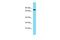 Myotubularin Related Protein 10 antibody, PA5-70833, Invitrogen Antibodies, Western Blot image 