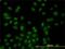 Serine/Threonine Kinase 17b antibody, H00009262-M01, Novus Biologicals, Immunocytochemistry image 