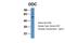 Dopa Decarboxylase antibody, NBP1-56918, Novus Biologicals, Western Blot image 