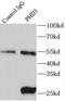 Egl-9 Family Hypoxia Inducible Factor 3 antibody, FNab06377, FineTest, Immunoprecipitation image 