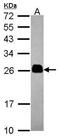 Transmembrane P24 Trafficking Protein 4 antibody, PA5-29564, Invitrogen Antibodies, Western Blot image 