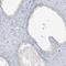 Scm Polycomb Group Protein Like 1 antibody, HPA035271, Atlas Antibodies, Immunohistochemistry paraffin image 