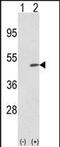 Tribbles Pseudokinase 2 antibody, PA5-49660, Invitrogen Antibodies, Western Blot image 