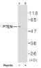Phosphatase And Tensin Homolog antibody, AP02597PU-N, Origene, Western Blot image 