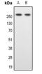 Spectrin Beta, Non-Erythrocytic 1 antibody, LS-C368927, Lifespan Biosciences, Western Blot image 