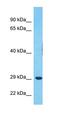 Ethanolamine-Phosphate Phospho-Lyase antibody, orb330571, Biorbyt, Western Blot image 