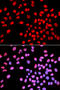 IKAROS Family Zinc Finger 1 antibody, 18-345, ProSci, Immunofluorescence image 