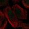 Kyphoscoliosis Peptidase antibody, NBP1-93859, Novus Biologicals, Immunofluorescence image 