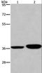 Apoptotic Peptidase Activating Factor 1 antibody, LS-C405390, Lifespan Biosciences, Western Blot image 