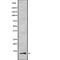 Mitochondrially Encoded NADH:Ubiquinone Oxidoreductase Core Subunit 3 antibody, abx216968, Abbexa, Western Blot image 