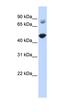 TBC1 Domain Family Member 16 antibody, orb325023, Biorbyt, Western Blot image 