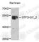 GTF2H2 Family Member C, Copy 2 antibody, A8297, ABclonal Technology, Western Blot image 