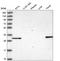 NSE4 Homolog A, SMC5-SMC6 Complex Component antibody, HPA044872, Atlas Antibodies, Western Blot image 