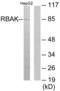 RB Associated KRAB Zinc Finger antibody, LS-C119289, Lifespan Biosciences, Western Blot image 