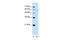 Phosphatidylinositol Glycan Anchor Biosynthesis Class V antibody, GTX46322, GeneTex, Western Blot image 