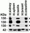 Angiotensin I Converting Enzyme 2 antibody, NBP1-76614, Novus Biologicals, Western Blot image 