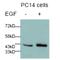 Jun Proto-Oncogene, AP-1 Transcription Factor Subunit antibody, AP02305PU-N, Origene, Western Blot image 