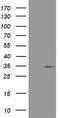 ATP Binding Cassette Subfamily B Member 1 antibody, TA801004, Origene, Western Blot image 