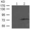 Protein Kinase C Theta antibody, TA324172, Origene, Western Blot image 
