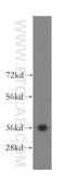 CDK-activating kinase assembly factor MAT1 antibody, 11719-1-AP, Proteintech Group, Western Blot image 