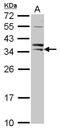 Siah E3 Ubiquitin Protein Ligase 1 antibody, NBP2-20356, Novus Biologicals, Western Blot image 