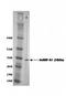 Non-SMC Condensin II Complex Subunit D3 antibody, orb76639, Biorbyt, Western Blot image 