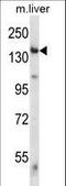 Eukaryotic Translation Initiation Factor 2 Alpha Kinase 4 antibody, LS-C164371, Lifespan Biosciences, Western Blot image 