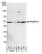 Poly(A) Binding Protein Nuclear 1 antibody, A303-524A, Bethyl Labs, Western Blot image 