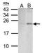 BCL2 Binding Component 3 antibody, PA5-34755, Invitrogen Antibodies, Western Blot image 