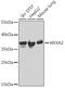 ANXA2 antibody, GTX32446, GeneTex, Western Blot image 