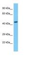 Transcriptional Adaptor 2B antibody, orb327112, Biorbyt, Western Blot image 