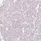 Calpain 3 antibody, NBP2-34061, Novus Biologicals, Immunohistochemistry frozen image 