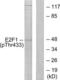E2F-1 antibody, LS-C198897, Lifespan Biosciences, Western Blot image 