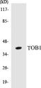 Transducer Of ERBB2, 1 antibody, EKC1570, Boster Biological Technology, Western Blot image 
