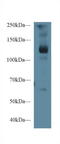 LIF Receptor Subunit Alpha antibody, LS-C295142, Lifespan Biosciences, Western Blot image 