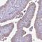 Polypeptide N-Acetylgalactosaminyltransferase 12 antibody, NBP2-14035, Novus Biologicals, Immunohistochemistry paraffin image 