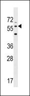 Leucine Rich Repeat Transmembrane Neuronal 2 antibody, LS-C158080, Lifespan Biosciences, Western Blot image 