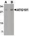 Autophagy-related protein 101 antibody, PA5-21000, Invitrogen Antibodies, Western Blot image 
