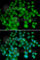 Thymosin Beta 4 X-Linked antibody, A5438, ABclonal Technology, Immunofluorescence image 