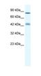 PARP2 antibody, orb329743, Biorbyt, Western Blot image 