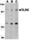 Toll Like Receptor 5 antibody, orb74672, Biorbyt, Western Blot image 