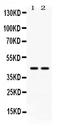 RAD51 Paralog C antibody, PB9792, Boster Biological Technology, Western Blot image 