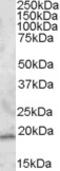 Regulator Of G Protein Signaling 13 antibody, LS-C112733, Lifespan Biosciences, Western Blot image 