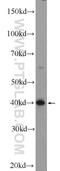 Armadillo Repeat Containing X-Linked 3 antibody, 25705-1-AP, Proteintech Group, Western Blot image 