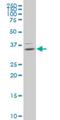 Homeobox B9 antibody, H00003219-M01, Novus Biologicals, Western Blot image 